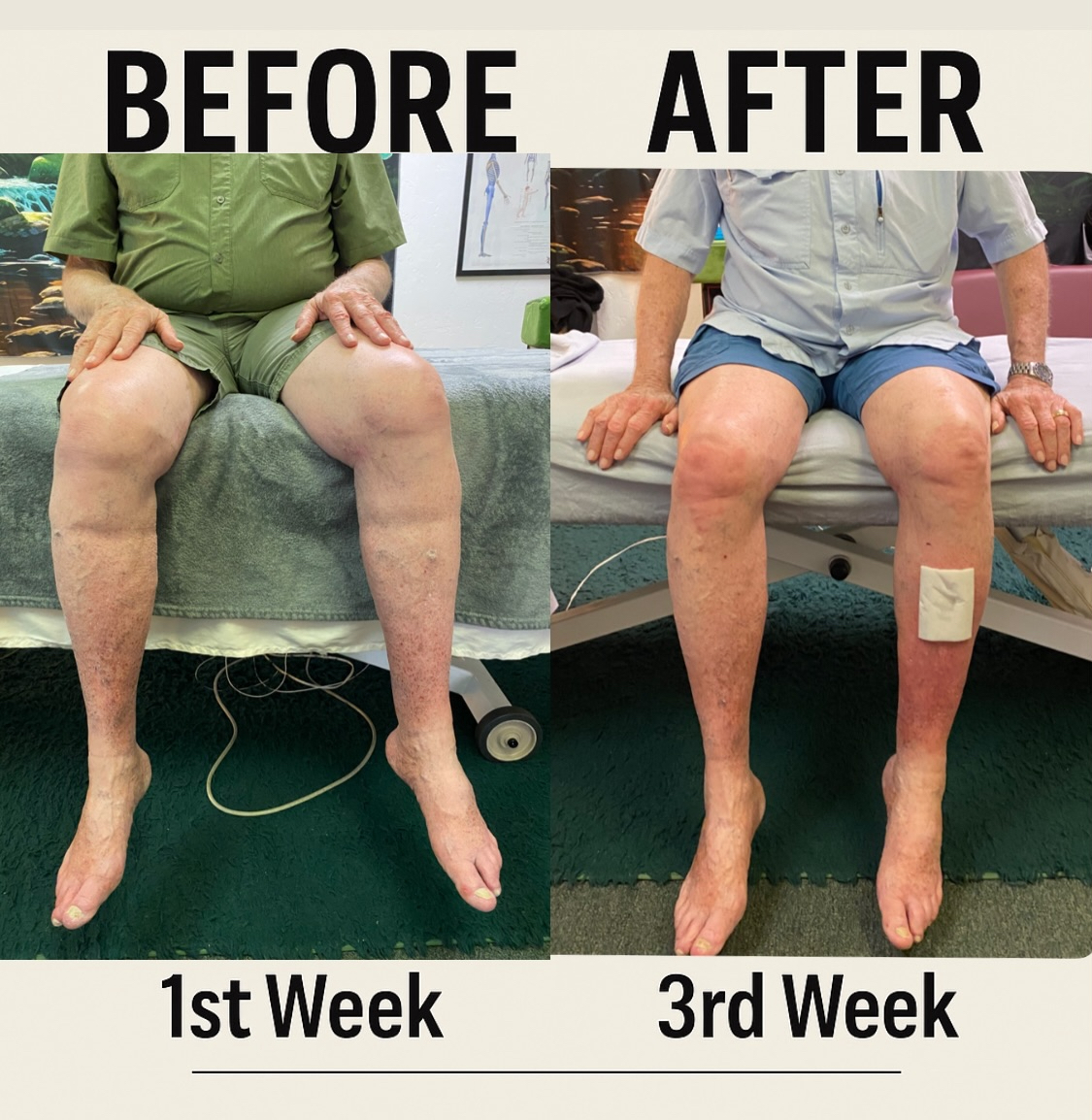 A client's posture, week one versus week three of treatment