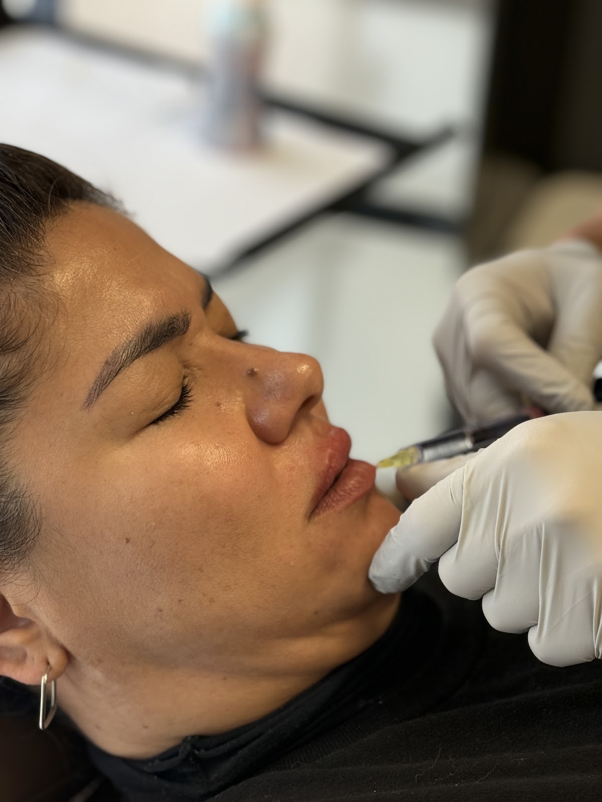 A precise injectable treatment in progress at Refined Radiance Aesthetics